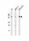 YES1 Antibody (N-term)